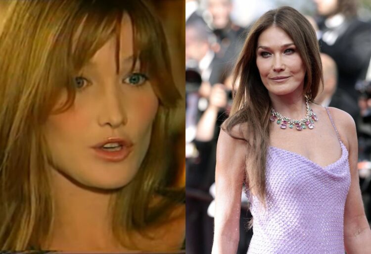 carla bruni prima e dopo